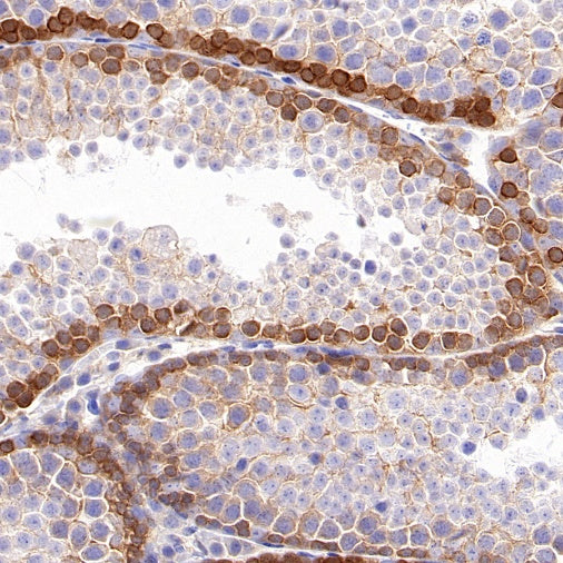 c-Rel Recombinant Rabbit mAb (S-1150-52)