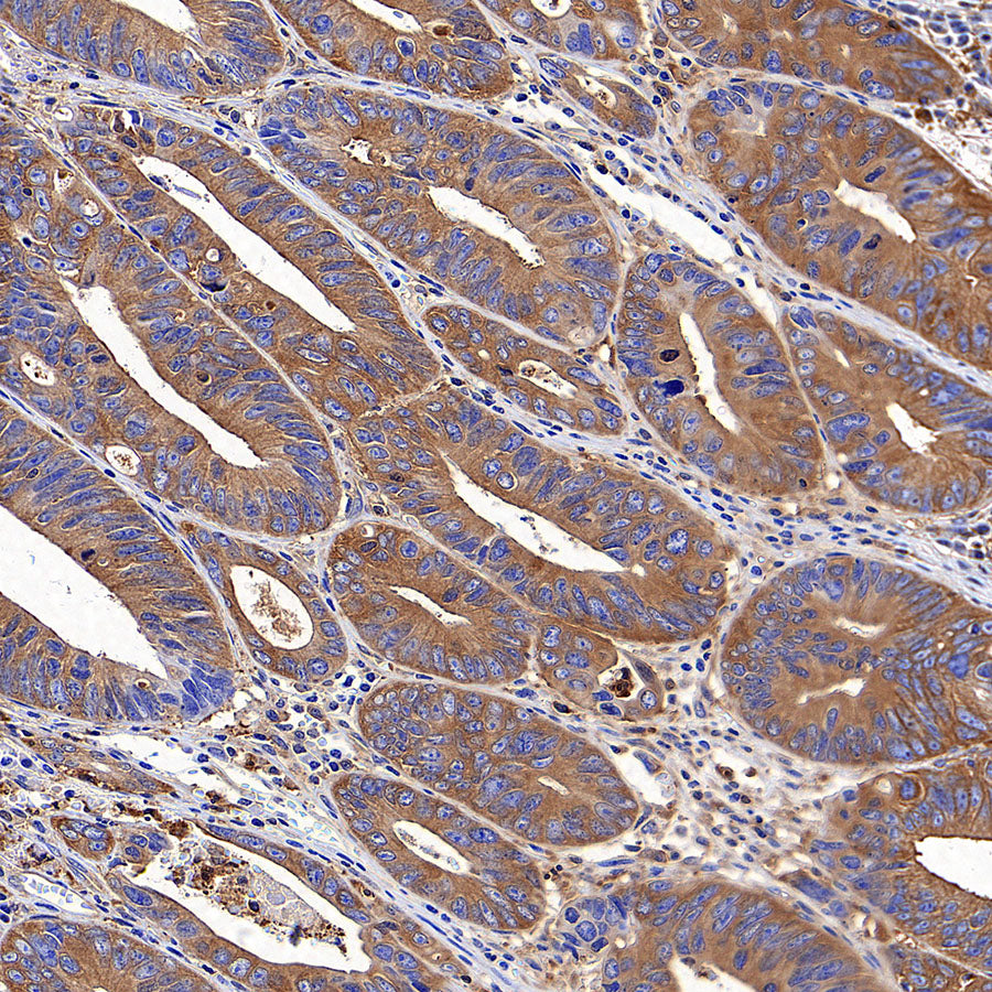 CAP1 Rabbit Polyclonal Antibody