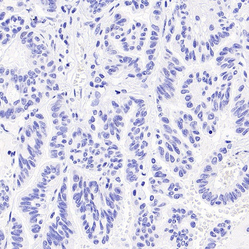 p40 Recombinant Rabbit mAb (SDT-166-116)