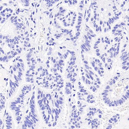 p40 Recombinant Rabbit mAb (SDT-166-116)