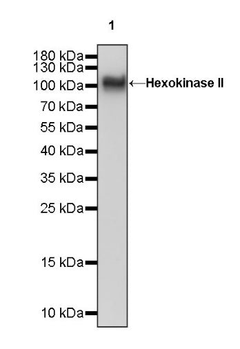 Hexokinase II Rabbit Polyclonal Antibody