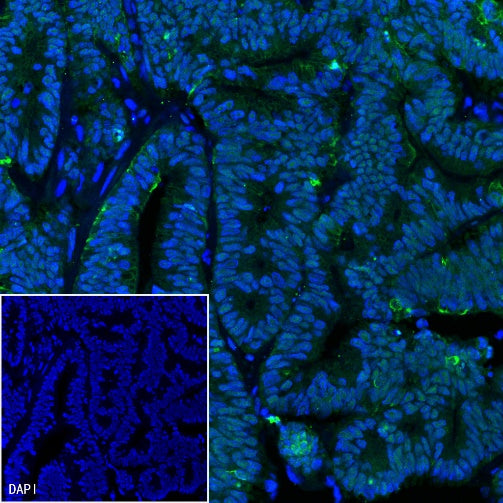 MSH2 Recombinant Rabbit mAb (Alexa Fluor® 488 Conjugate) (SDT-037-20)