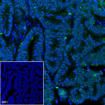 MSH2 Recombinant Rabbit mAb (Alexa Fluor® 488 Conjugate) (SDT-037-20)