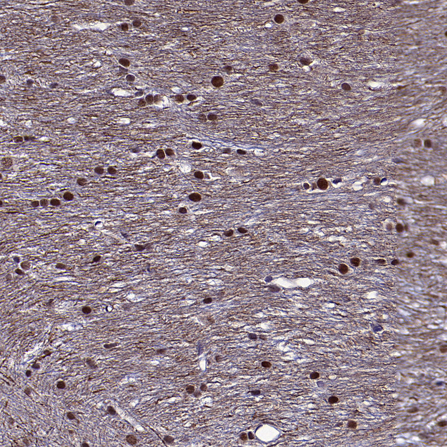 METTL1 Recombinant Rabbit mAb (S-4435-6)