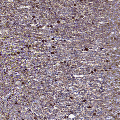 METTL1 Recombinant Rabbit mAb (S-4435-6)