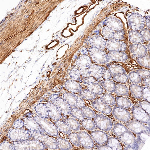 EHD2 Recombinant Rabbit mAb (S-1580-60)