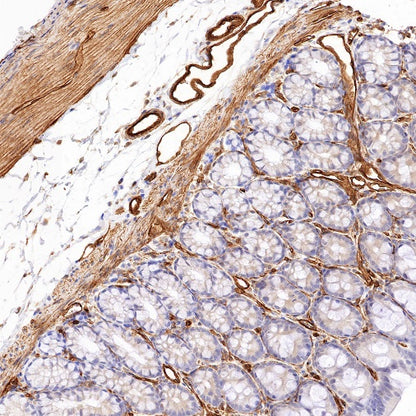 EHD2 Recombinant Rabbit mAb (S-1580-60)