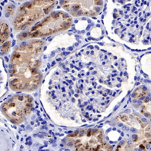 cGAS Recombinant Rabbit mAb (S-708-15)