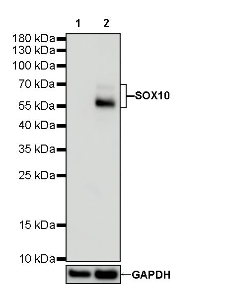 SOX10 Recombinant Rabbit mAb (SDT-136-59)