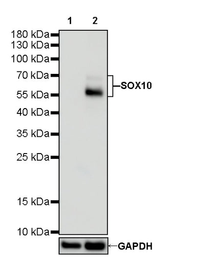 SOX10 Recombinant Rabbit mAb (SDT-136-59)