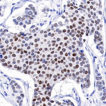 Progesterone Receptor Recombinant Rabbit mAb (SDT-R123)