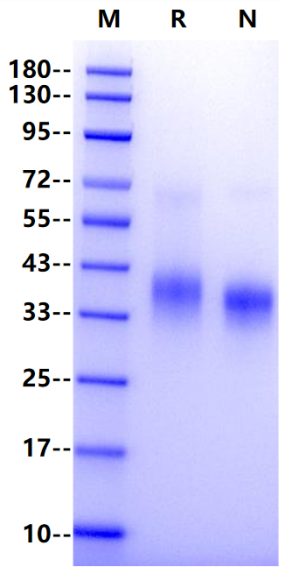 IL-2R alpha/CD25 His Tag Protein, Human