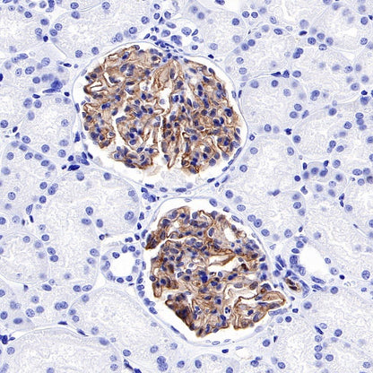 Claudin 5 Recombinant Rabbit mAb (SDT-R322)