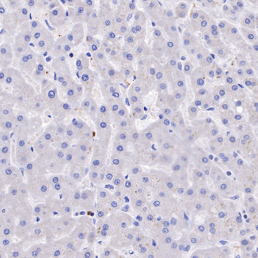CD42b Recombinant Rabbit mAb (SDT-R147)