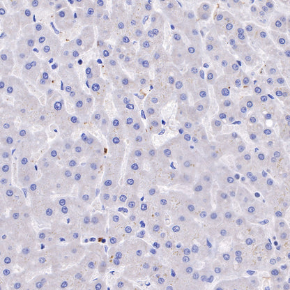 CD42b Recombinant Rabbit mAb (SDT-R147)