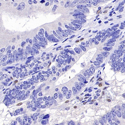 TCF-4 Recombinant Rabbit mAb,PBS Only (SDT-2549-4)