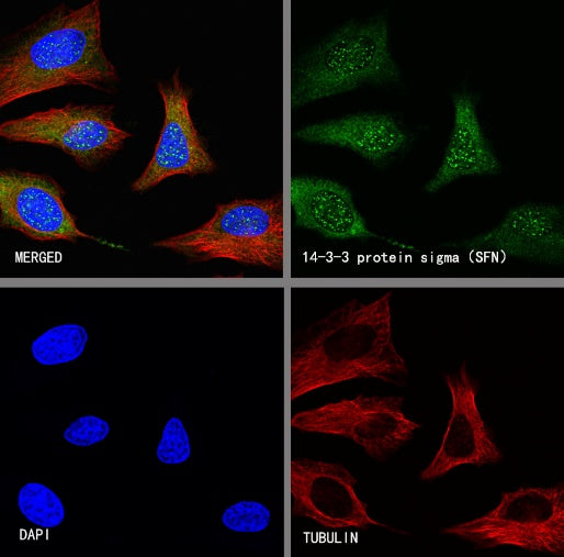 14-3-3 sigma Recombinant Rabbit mAb (S-2017-59)