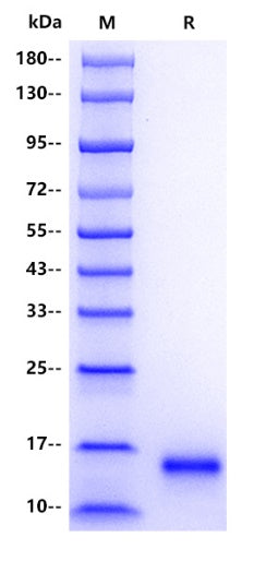 Human FIS1 Protein, His tag