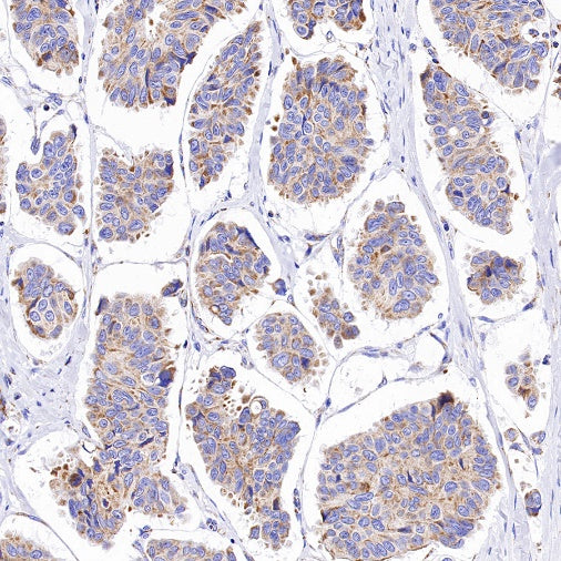 ATP5B Recombinant Rabbit mAb (S-1271-29)