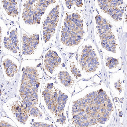 ATP5B Recombinant Rabbit mAb (S-1271-29)