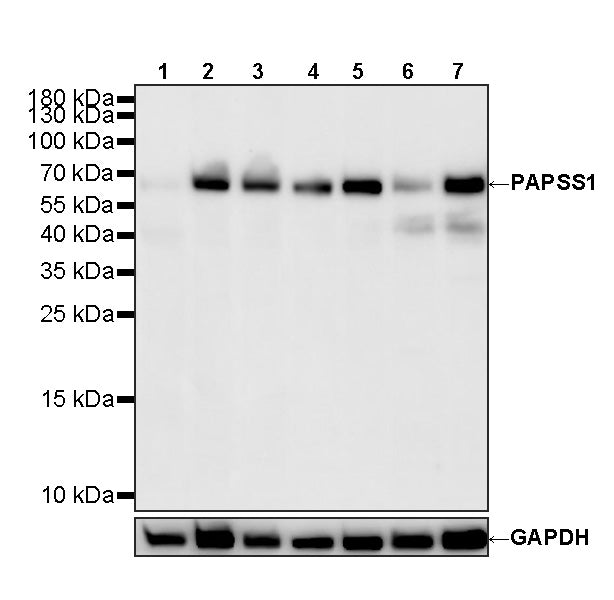 PAPSS1 Recombinant Rabbit mAb (S-3516-23)