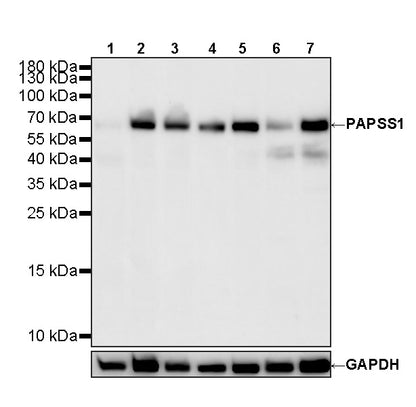 PAPSS1 Recombinant Rabbit mAb (S-3516-23)