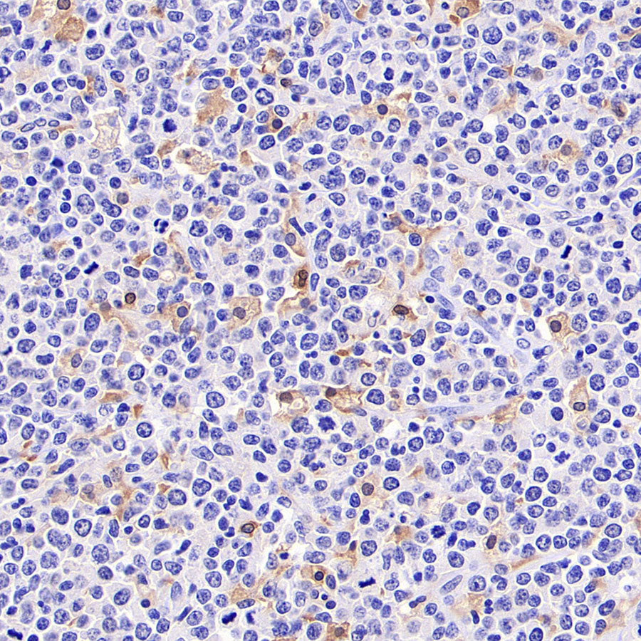 Noxa Recombinant Rabbit mAb (S-5505)