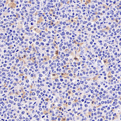 Noxa Recombinant Rabbit mAb (S-5505)