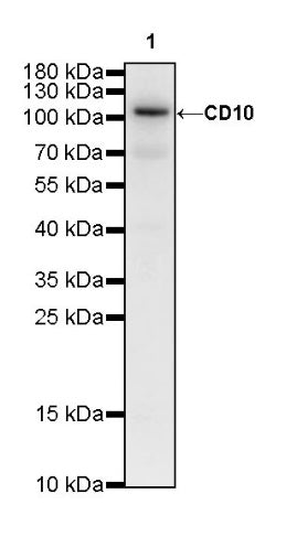 CD10 Recombinant Rabbit mAb (SDT-006-77)