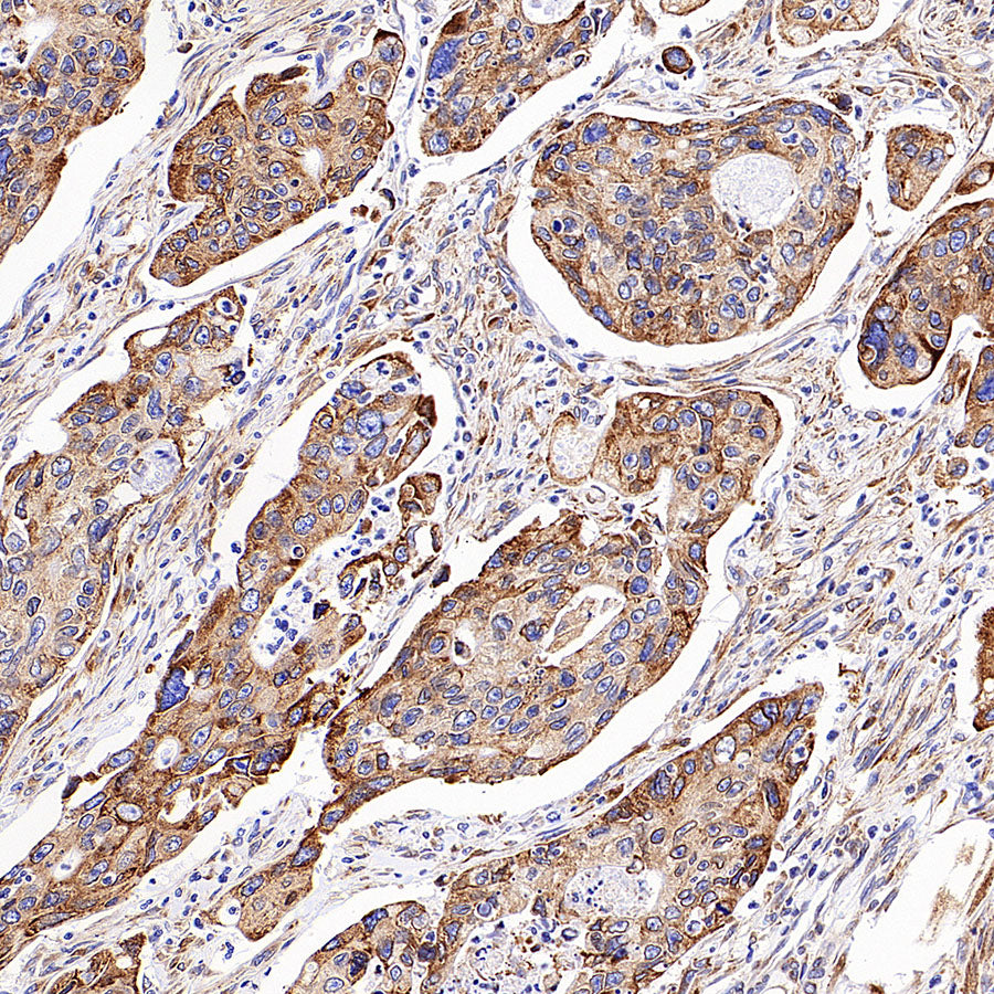 NTSR1 Recombinant Rabbit mAb (S-4844-38)