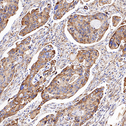 NTSR1 Recombinant Rabbit mAb (S-4844-38)