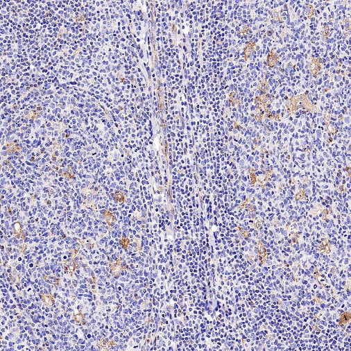 M6PR Recombinant Rabbit mAb (S-2348-14)