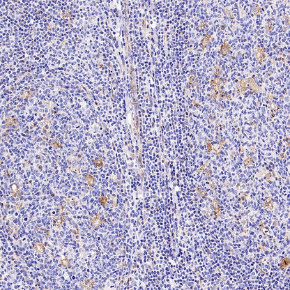 M6PR Recombinant Rabbit mAb (S-2348-14)