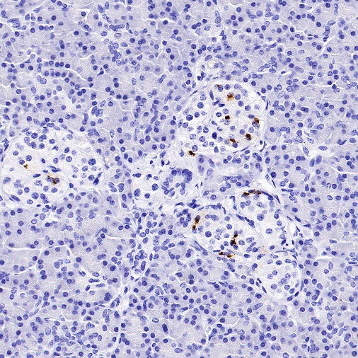 Somatostatin Recombinant Rabbit mAb (S-1103-79)
