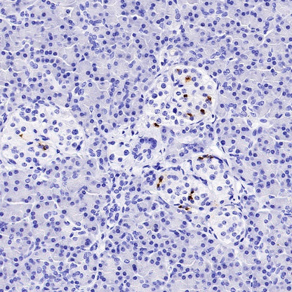 Somatostatin Recombinant Rabbit mAb (S-1103-79)
