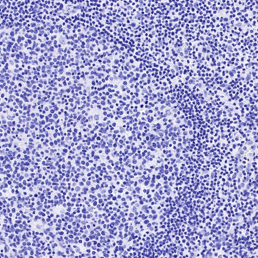 α/β-Synuclein Recombinant Rabbit mAb (S-309-72)
