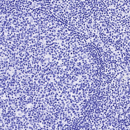 α/β-Synuclein Recombinant Rabbit mAb (S-309-72)