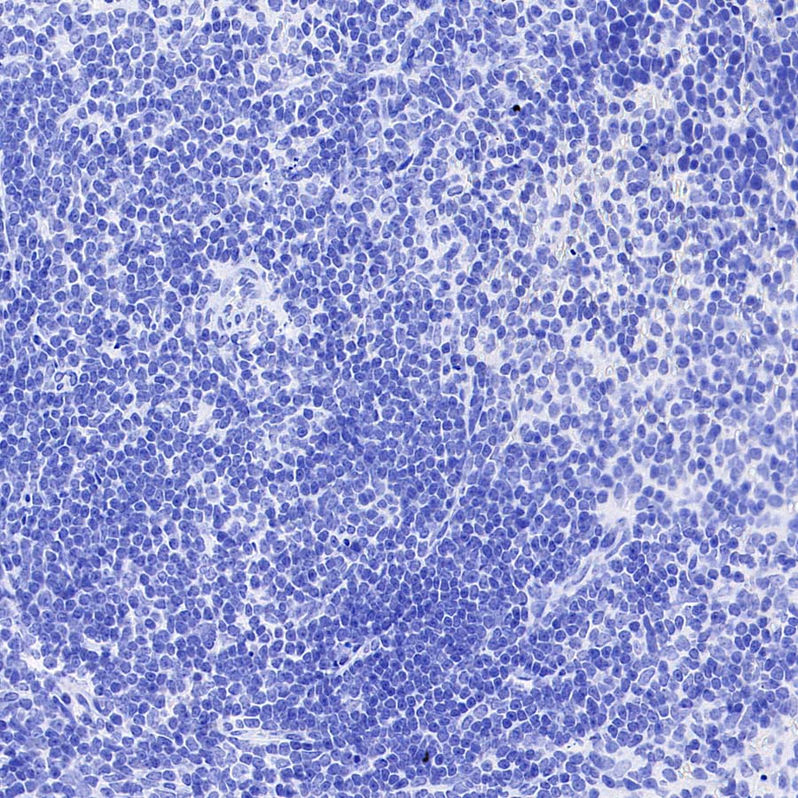 HER2/ErbB2 Recombinant Rabbit mAb (S-3935-58)