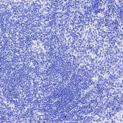 HER2/ErbB2 Recombinant Rabbit mAb (S-3935-58)
