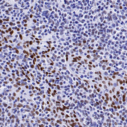 KDM1/LSD1 Recombinant Rabbit mAb (S-1280-80)