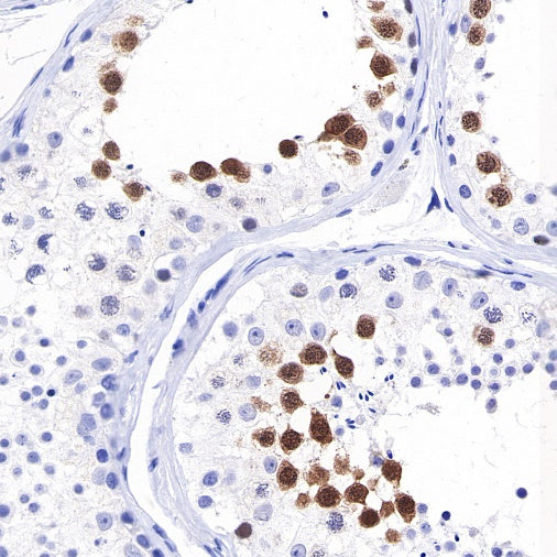 Geminin Recombinant Rabbit mAb (S-427-204)