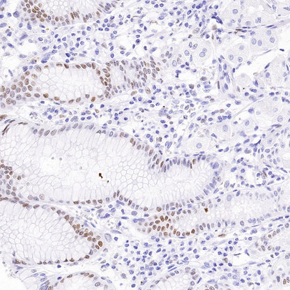 c-Fos Recombinant Rabbit mAb (S-1391-63)