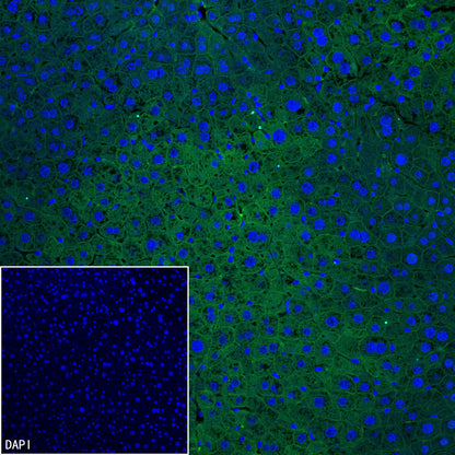 SLC43A2 Recombinant Rabbit mAb (S-4492-33)