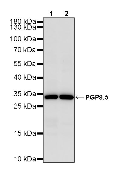 PGP9.5 Recombinant Mouse mAb (S-6071)
