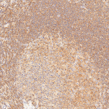 CDC42 Recombinant Rabbit mAb (S-6126)