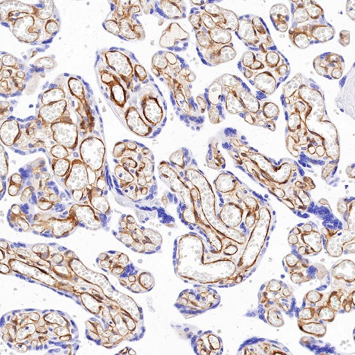 EHD2 Recombinant Rabbit mAb (S-1580-60)