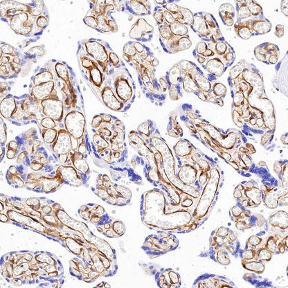 EHD2 Recombinant Rabbit mAb (S-1580-60)