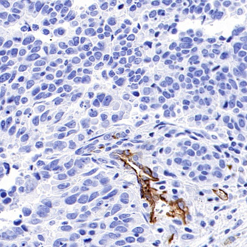 Claudin 5 Recombinant Rabbit mAb (SDT-R322)
