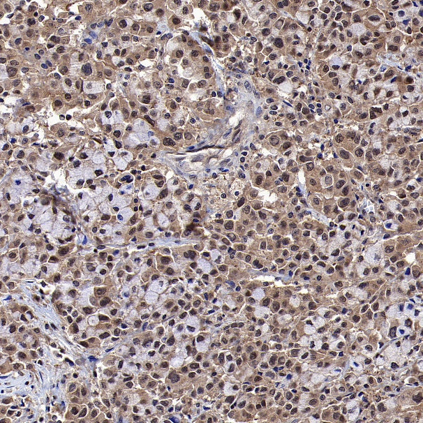 IRF3 Recombinant Rabbit mAb (S-4395)