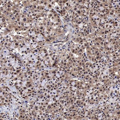 IRF3 Recombinant Rabbit mAb (S-4395)